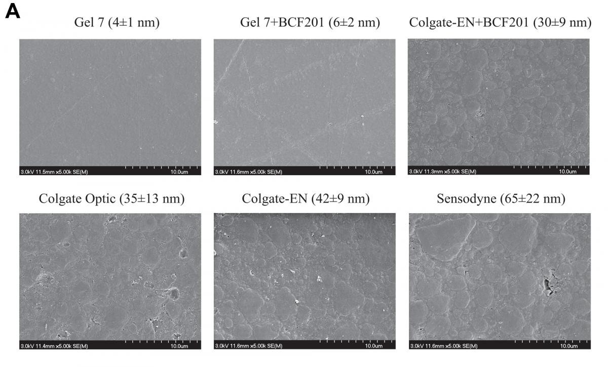 figure 5 A- Scanning electron microscope images of representative samples of resin-based composite