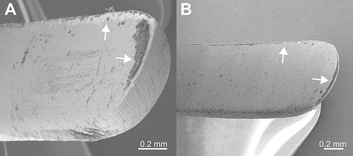 http://jcda.ca/sites/default/files/h11/fig3.jpg