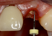 🔴Le #caséum 👇: est un - Médecine dentaire en poche
