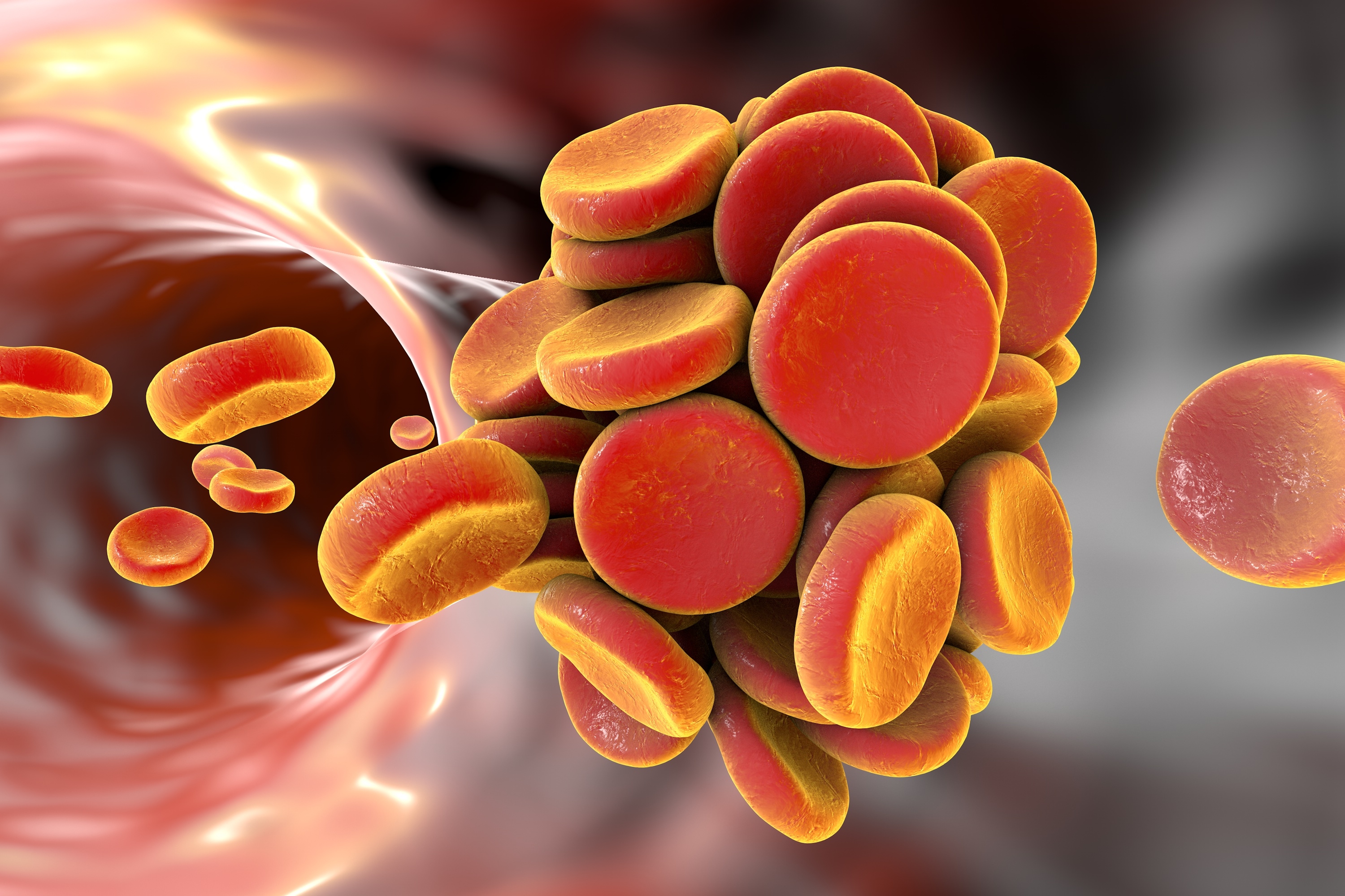 Management of patients with anticoagulant-associated bleeding or urgent