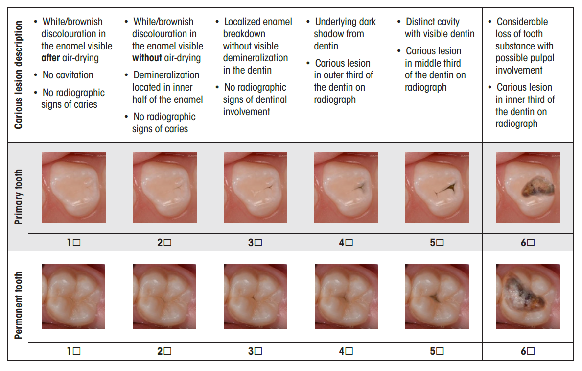 images of teeth in various stages of decay