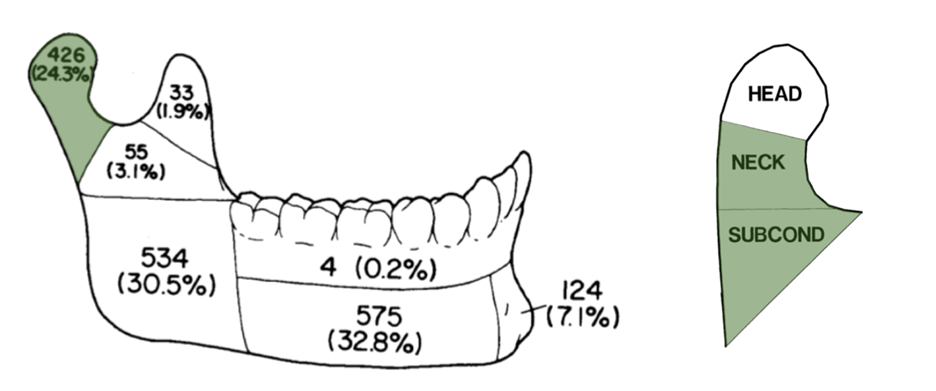 mandibular fractures image