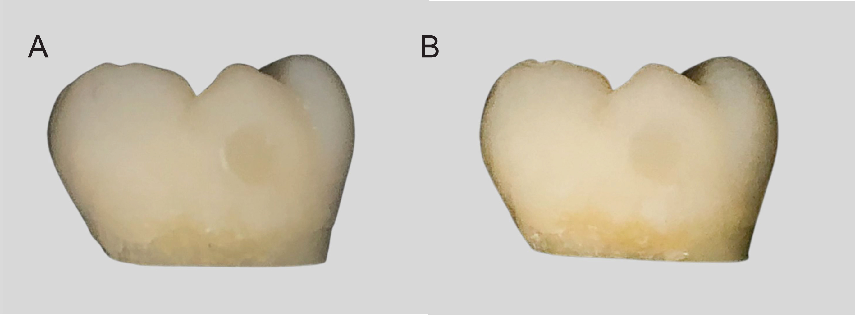 2 teeth side by side