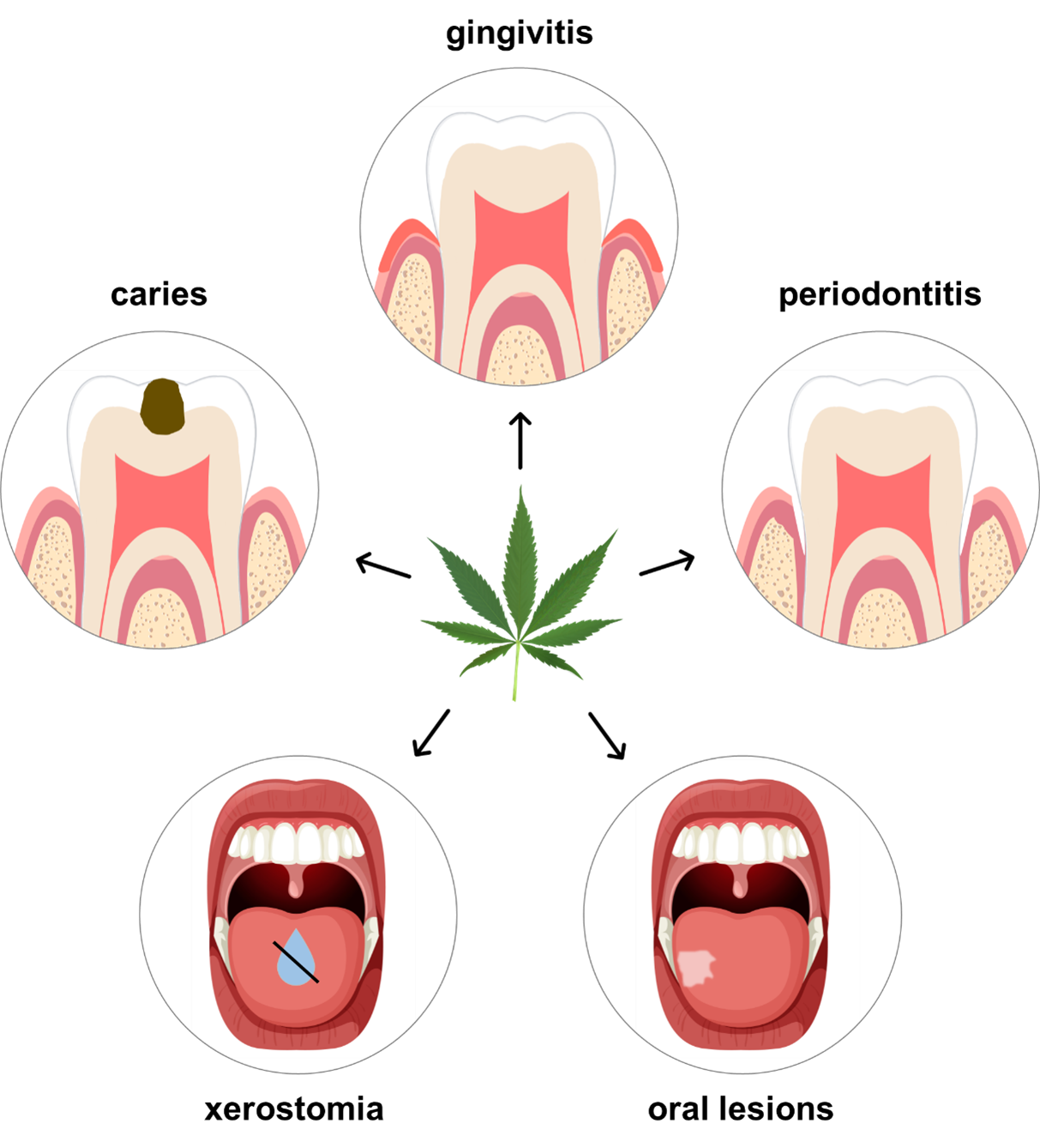 figure 3 cannabis impact on dental health