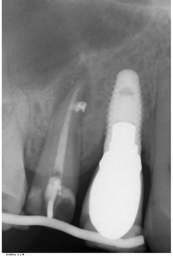 radiograph image